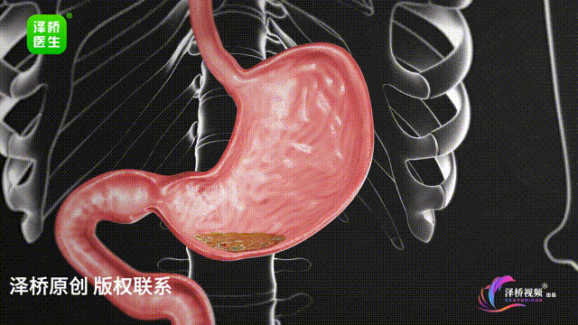 7个睡眠坏习惯，小心变胖又变丑(图2)